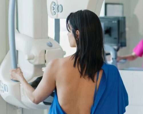 Screening Mammografico